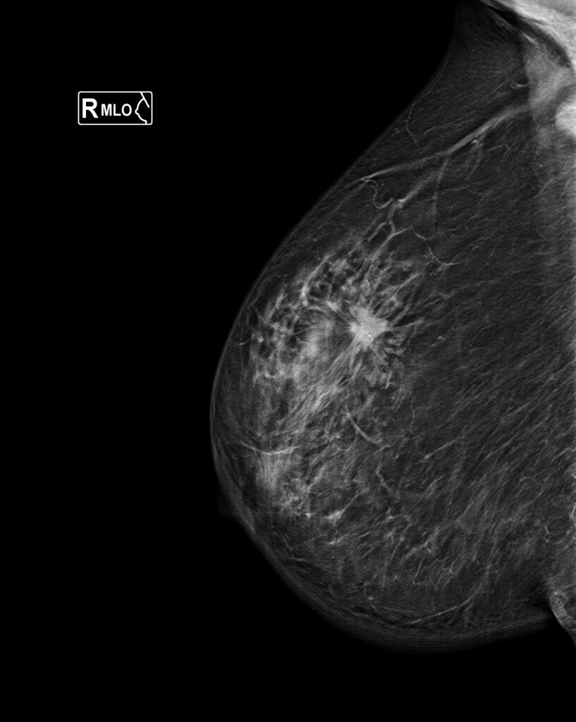 CATEGORIAS BI-RADS v2025 1.2.826.0.1.3680043.6.57604.56823.20250312182029.15368.1.18