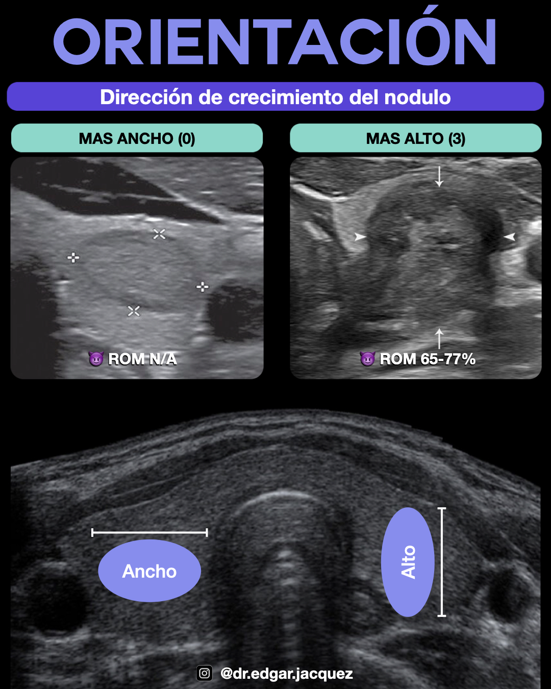 Ejemplo Forma Más alto que ancho