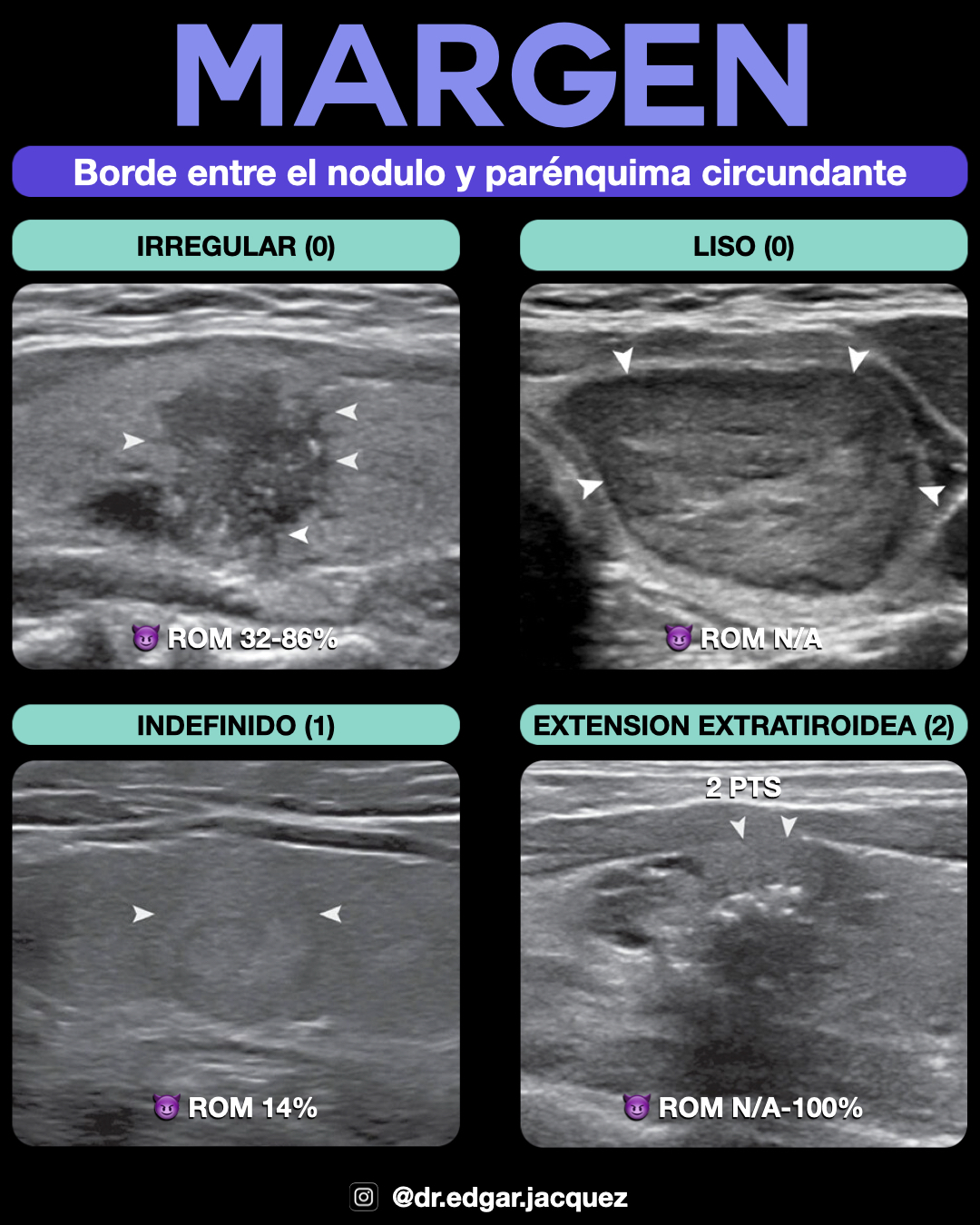Ejemplo Márgenes Irregulares / ETE