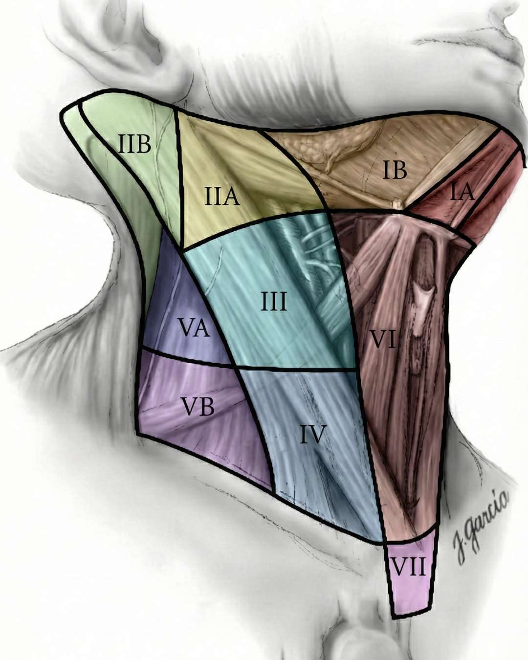 Mapa de Niveles Ganglionares Cervicales